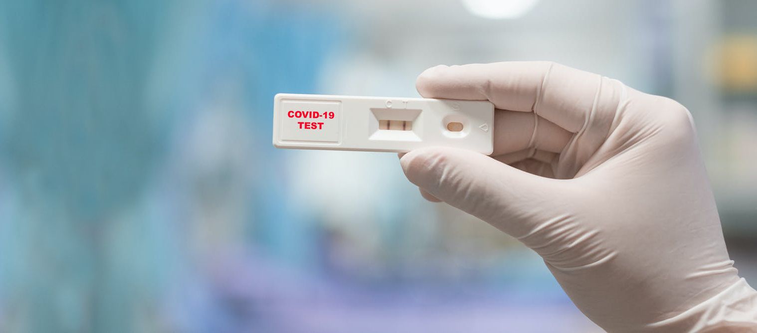 Per fer el test no cal cita prèvia i l'horari és de dilluns a divendres de 9.00 h a 13.00 h i de 15.00 h a 19.00 h. FOTO: Cedida