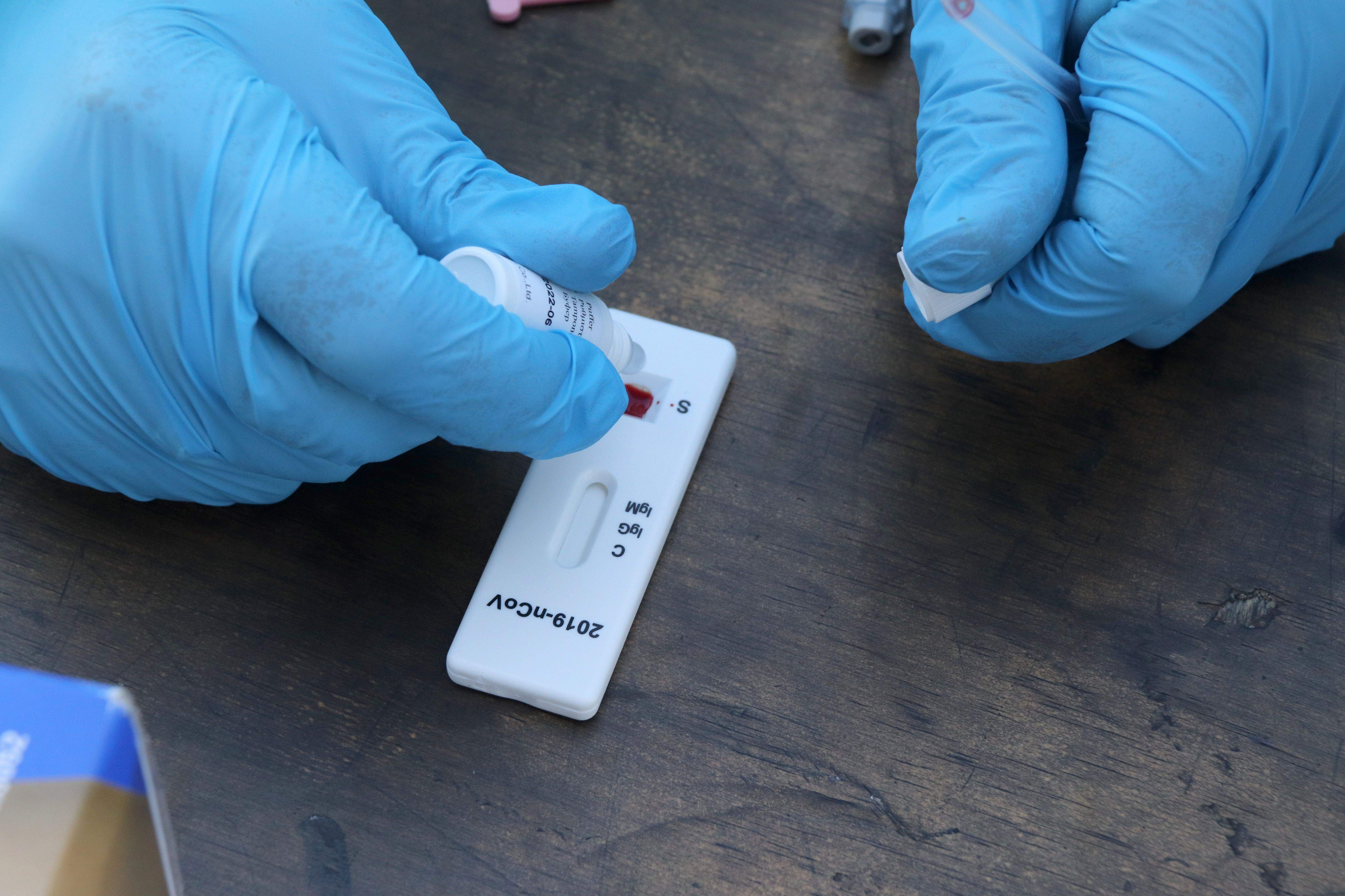 Un test d'antígens. FOTO: Eloi Tost (ACN)