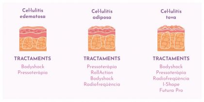 celulitis celulitis