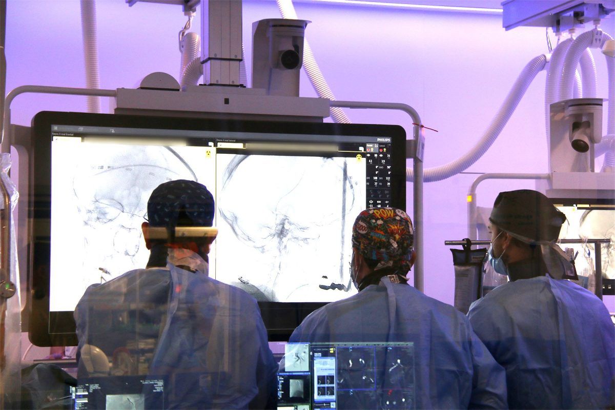 El 2023, 125 pacients han estat tractats amb fibrinòlisi i o trombectomia per retirar el coàgul de l’artèria. FOTO: Parc Taulí