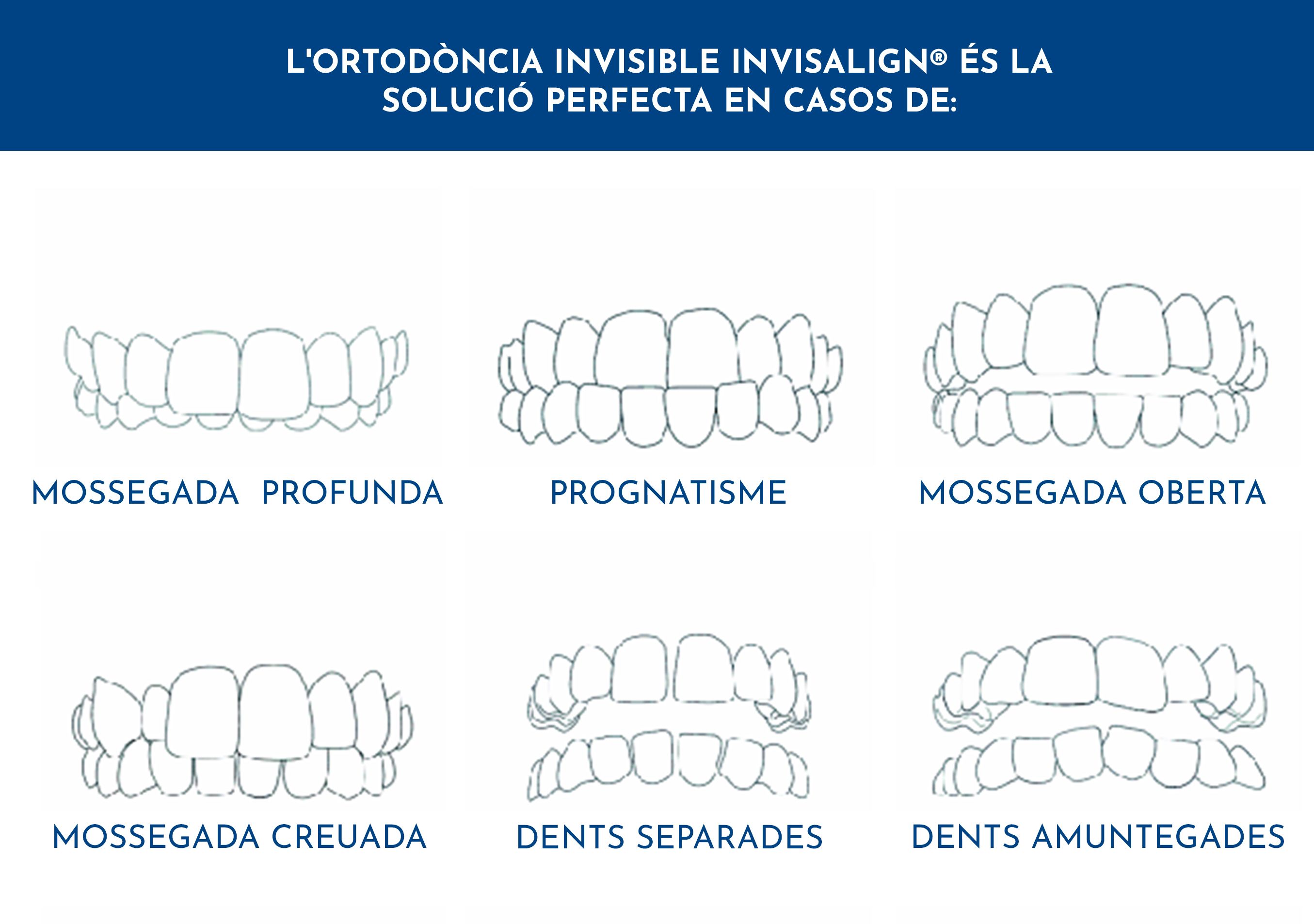 ortodoncia invisible  