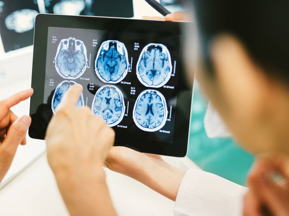 Investigadors analitzant un cervell. FOTO: El Confidencial 