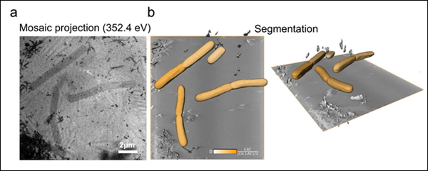 (a) Imatge de raigs X de bacteris després de l'exposició al biomaterial nanoestructurat. (b) Reconstrucció tridimensional que mostra bacteris individuals (en color) i cristalls del material de fosfat càlcic (en gris). Foto: Cedida