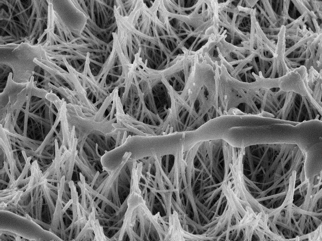 matges de microscòpia electrònica de rastreig per emissió de camp on es veuen les nanoagulles matant els bacteris. Foto: Cedida